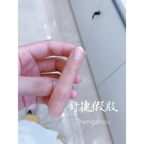 安裝假手指的接口如何處理比較好？