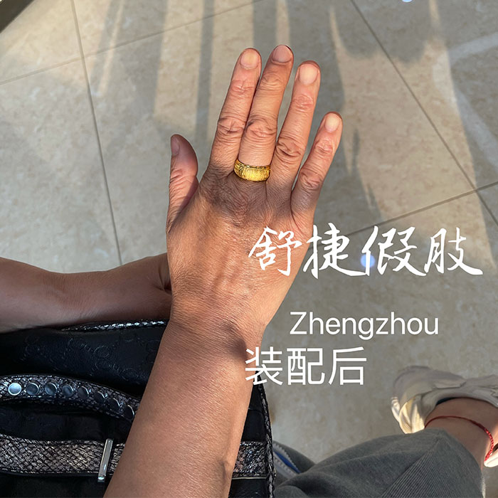 美容假手，假手指.jpg