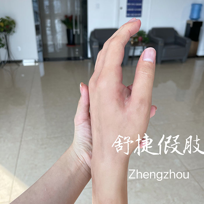 假手，美容假手