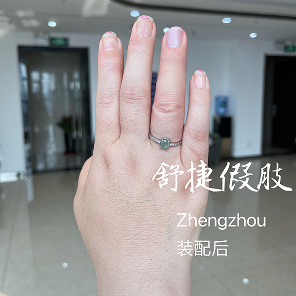 美容假手指裝配后效果，根本看不出來(lái)